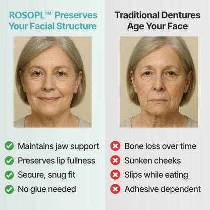 🌎Ends Today: 70% OFF! ROSOPL Custom-Fit Full Functional DenturesMake you more confident
